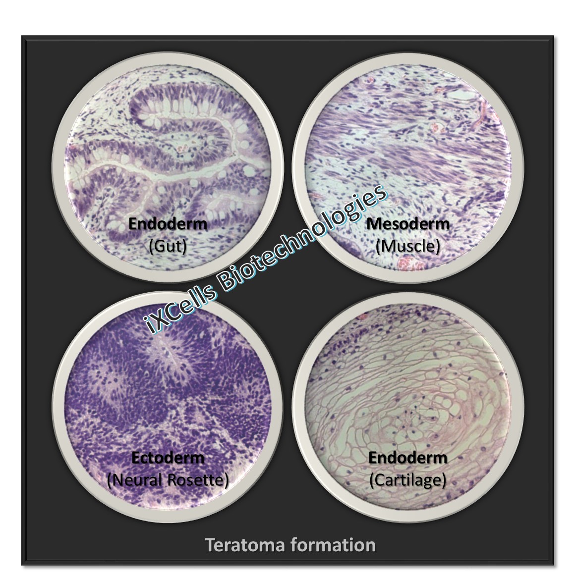 Teratoma formation